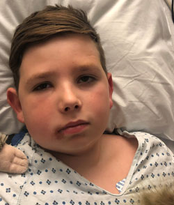 Damien after surgery in the hybrid OR. 